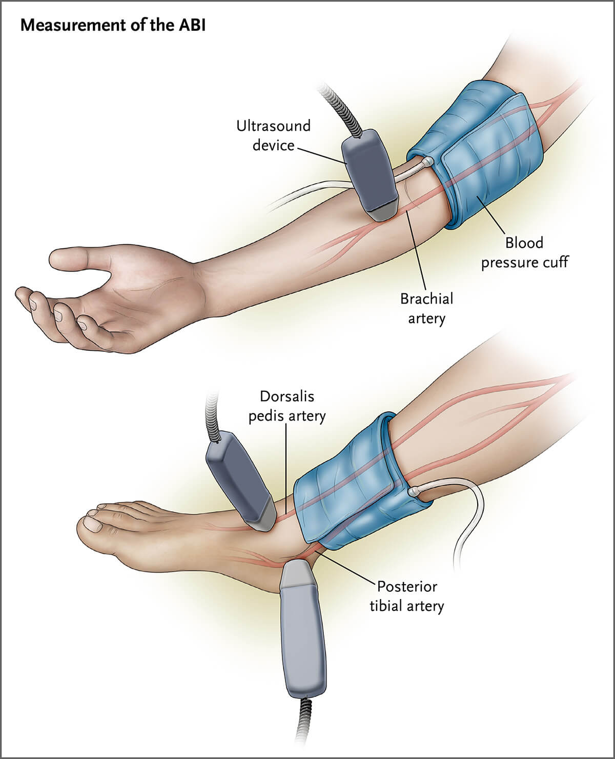 在每一次动脉血流定位后,使用血压袖带来记录上肢肱动脉和踝部动脉的