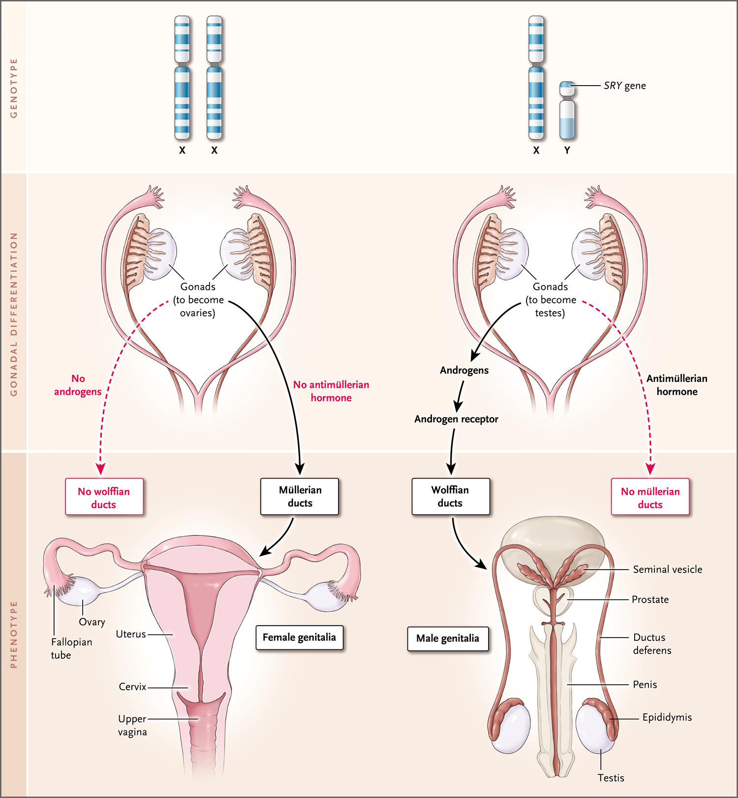 1. 典型的性腺和表型性别分化