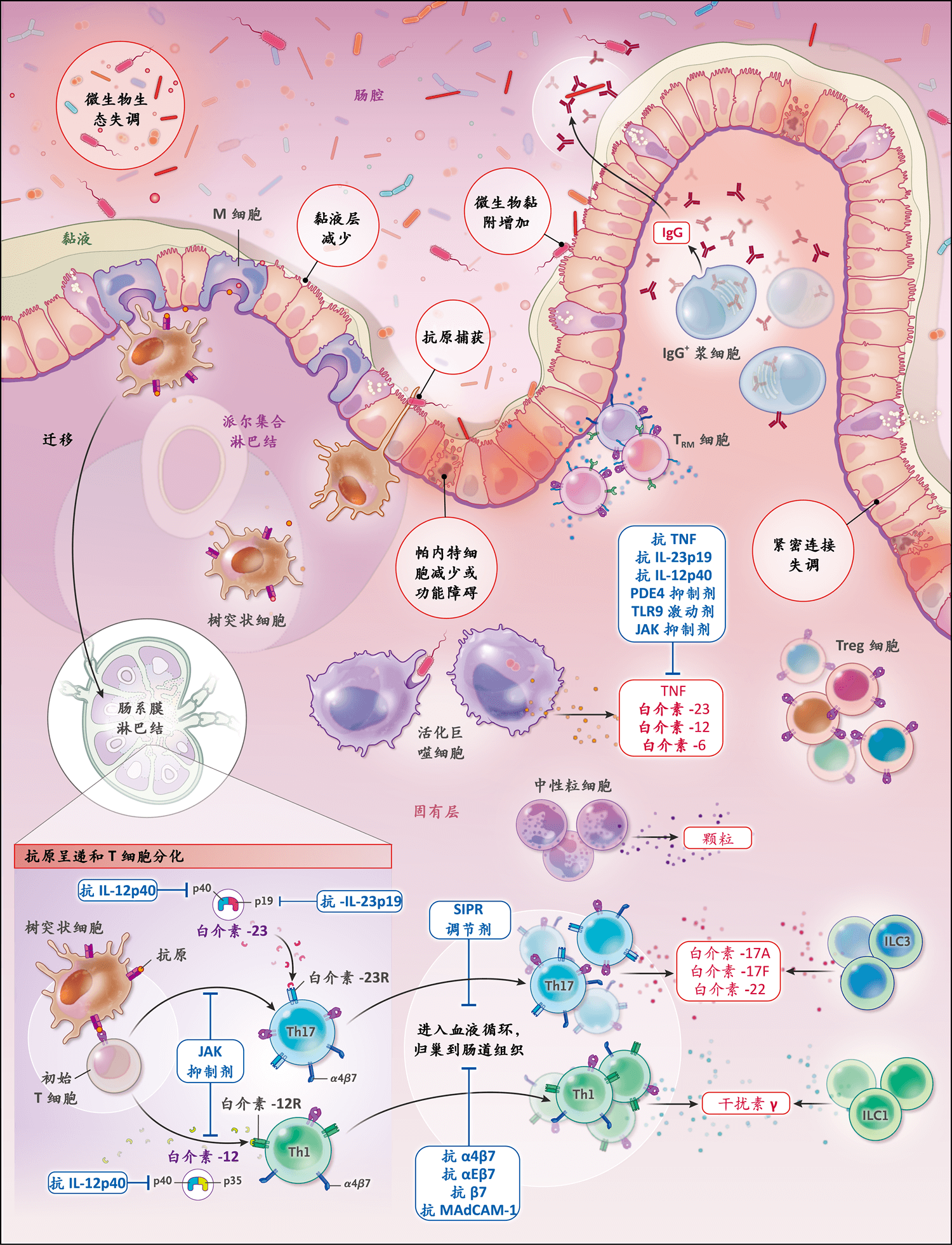 图2 炎性肠病(ibd)中的肠黏膜免疫系统