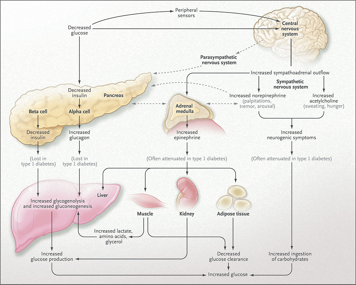 糖尿病低血糖性自主神经衰竭的机制 NEJM医学前沿