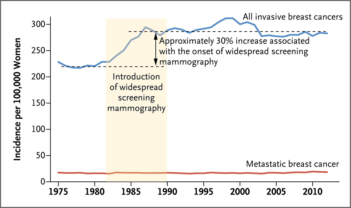 乳腺癌肿瘤大小 过度诊断和乳房x线照相术的有效性 Nejm医学前沿