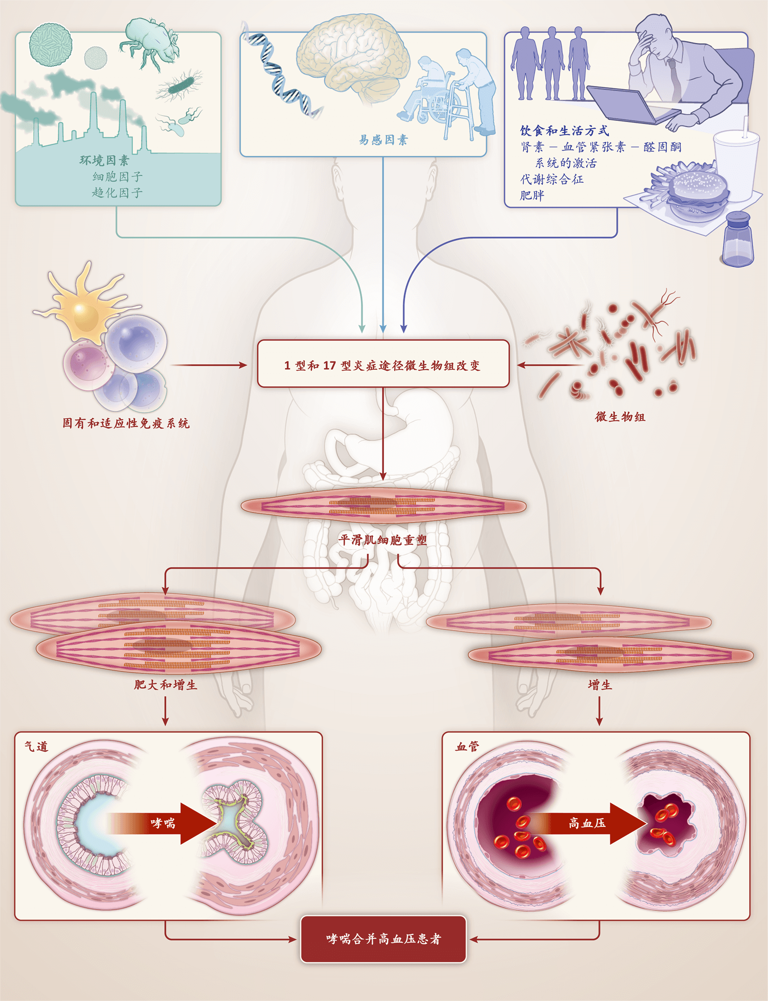 高血压和哮喘之间的机制关联 易感因素(遗传特征,压力和年龄),饮食和